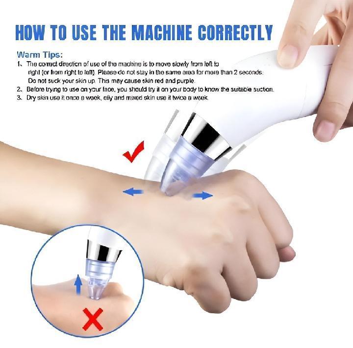 Dead Skin Removal Derma Suction Facial Cleanser