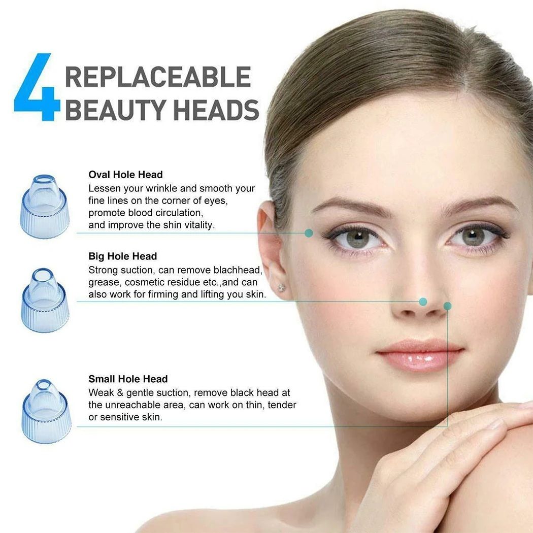 Deep Clean with Ease – 4-in-1 Derma Suction Blackhead Remover, Battery Operated & Powerful!