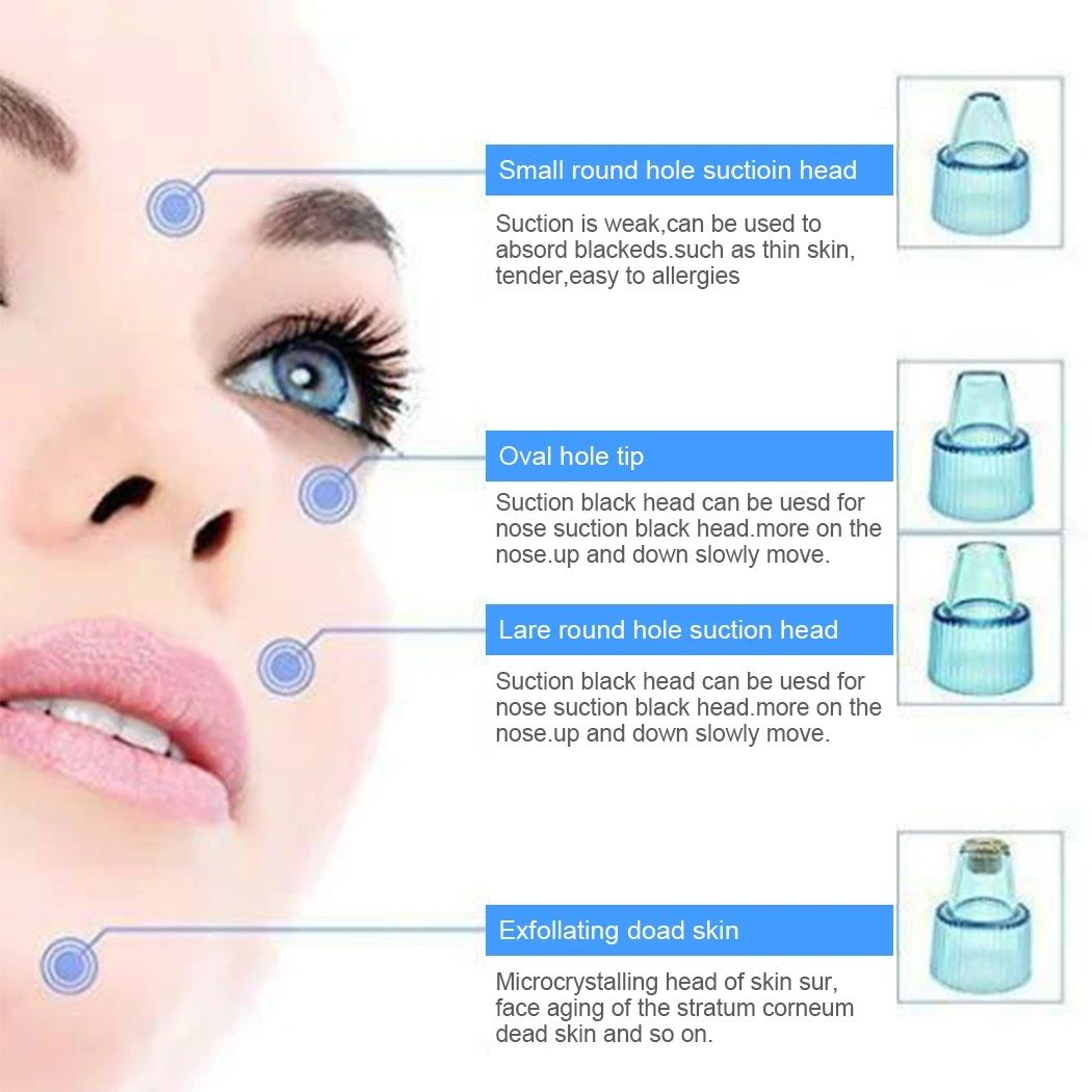 Deep Clean with Ease – 4-in-1 Derma Suction Blackhead Remover, Battery Operated & Powerful!