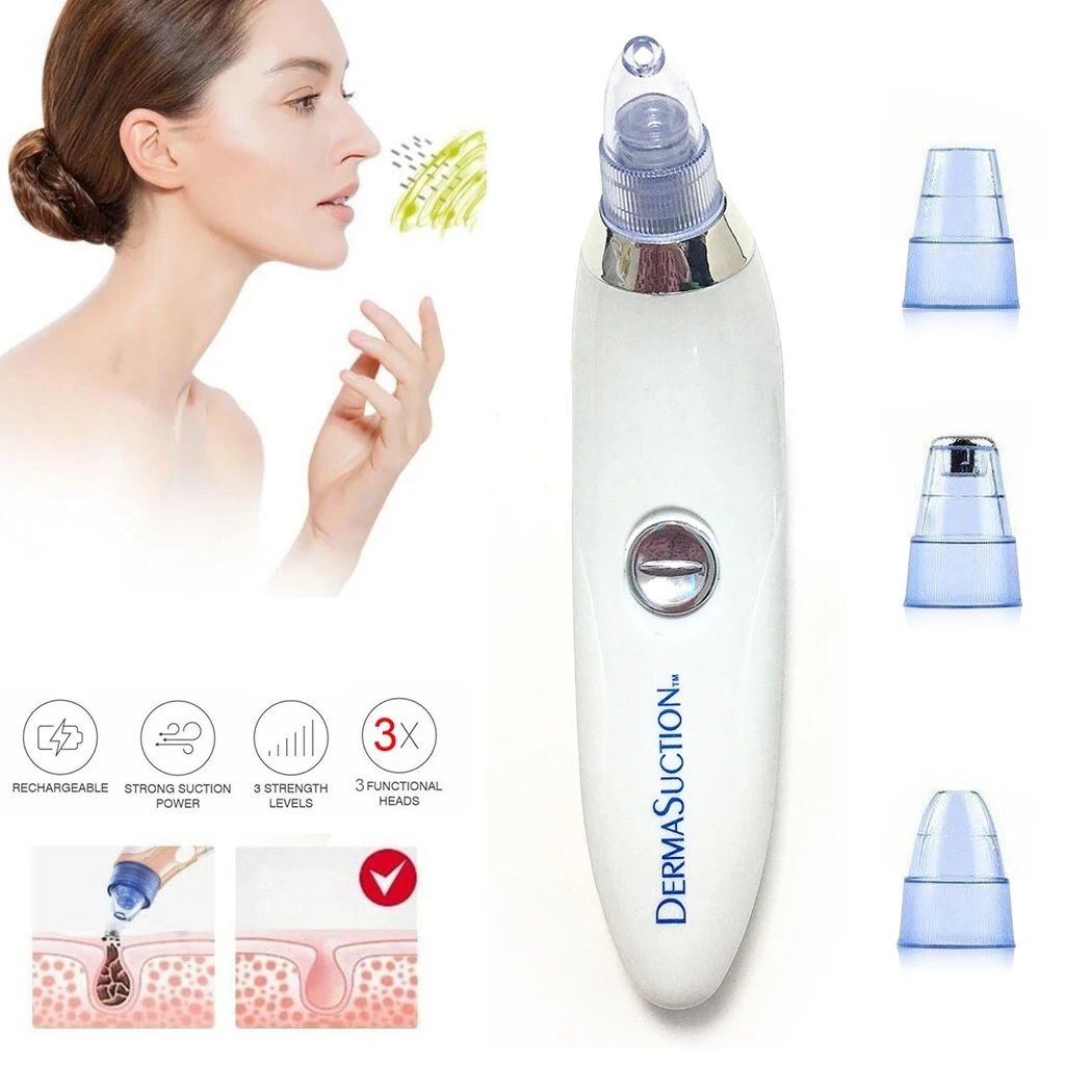Deep Clean with Ease – 4-in-1 Derma Suction Blackhead Remover, Battery Operated & Powerful!