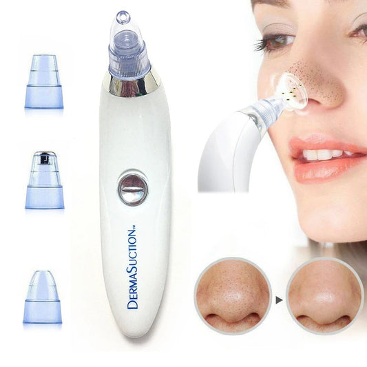 Deep Clean with Ease – 4-in-1 Derma Suction Blackhead Remover, Battery Operated & Powerful!